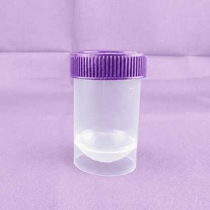 40mL round bottom Sterile Sperm Collection Cups
